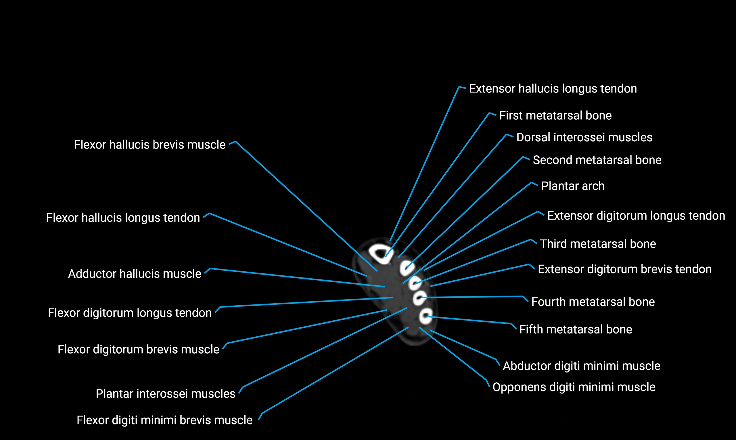 CT lower limb axial cross sectional anatomy labelled image 187 (2).webp